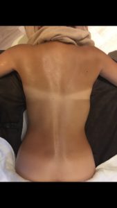インディバエステ ビフォーアフター