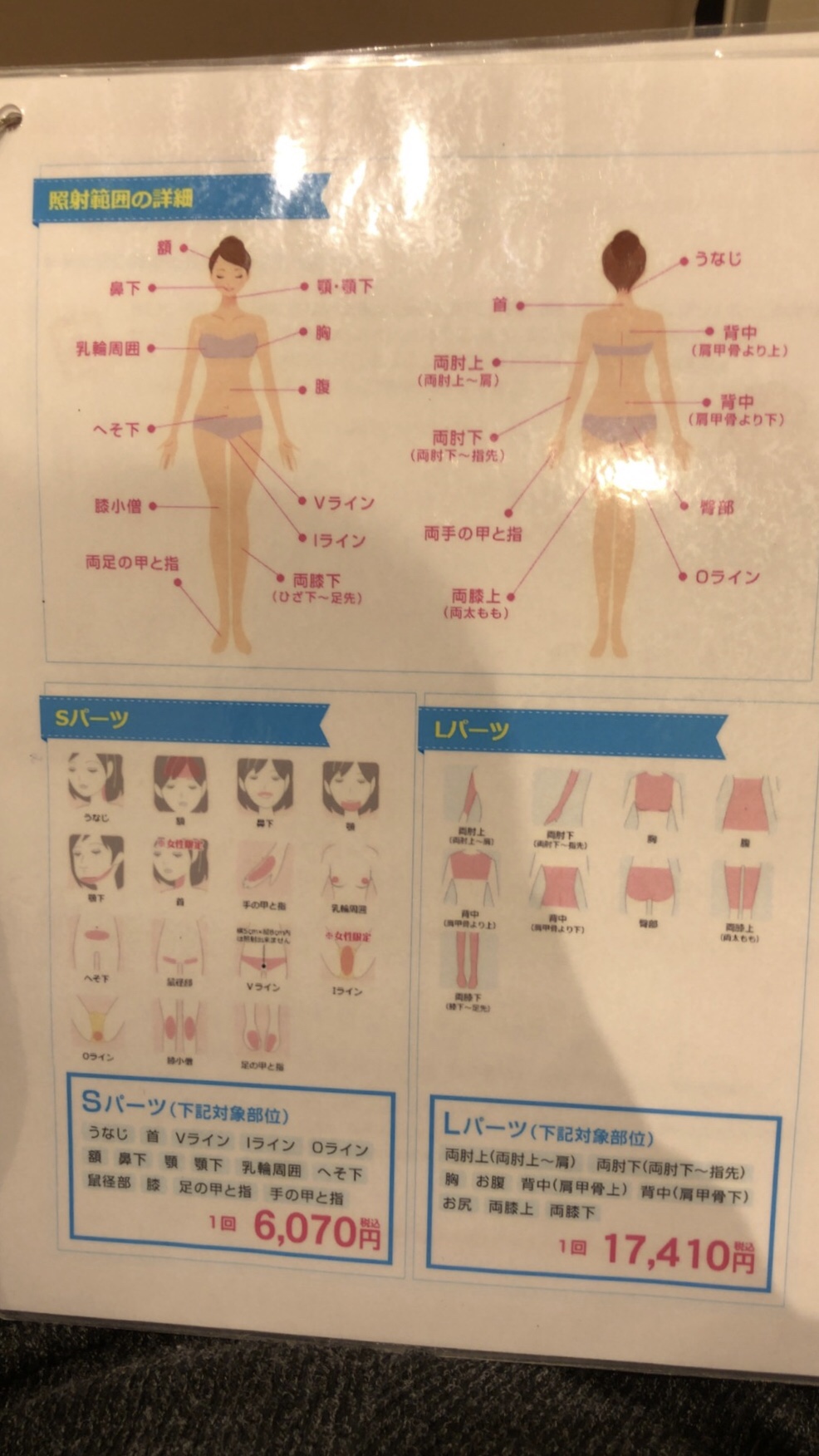 脱毛部位 湘南美容クリニック